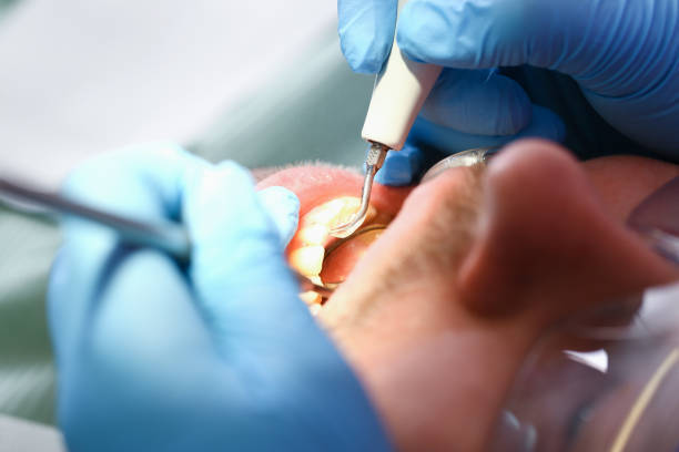 Best Broken Tooth Emergency  in Austin, AR